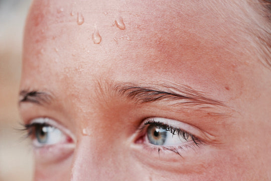 Sweat for Clear Skin