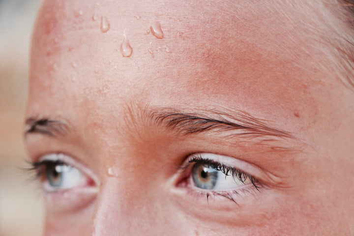 Sweat for Clear Skin