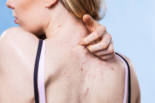 Five Common Spring Skin Allergies and How to Ease Them